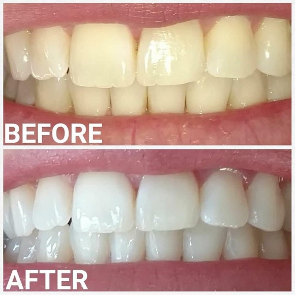 Whitening Toothpaste - Picture 7 of 9